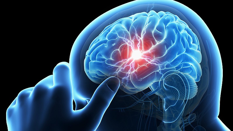 Искусственный интеллект обнаруживает травмы головы  | Esmynews