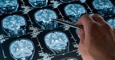 Искусственный интеллект обнаруживает травмы головы | Esmynews