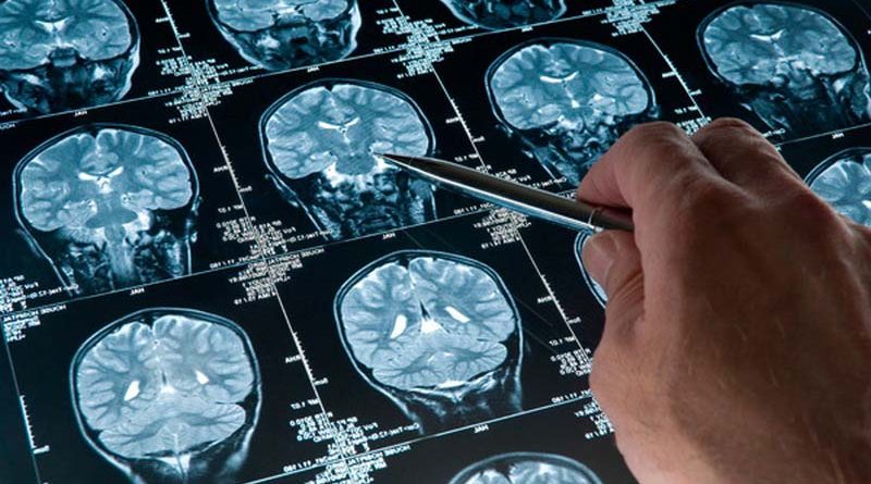 Искусственный интеллект обнаруживает травмы головы | Esmynews